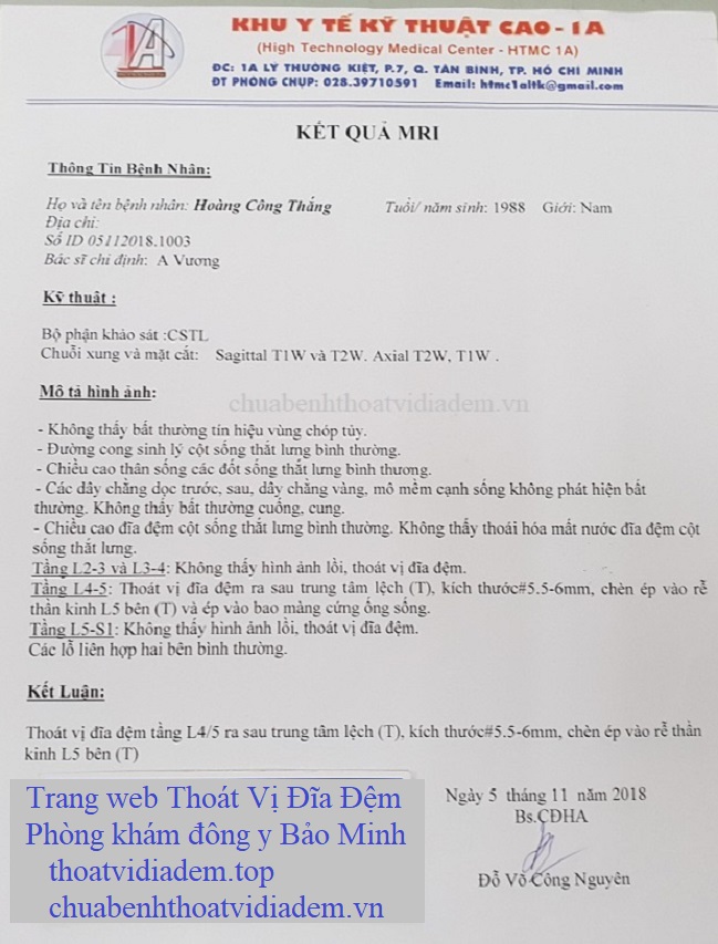 Thoát vị đĩa đệm đau bên trái